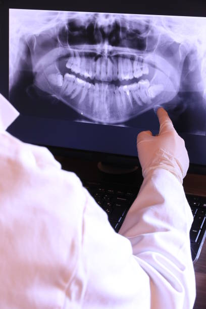 Best Emergency Tooth Extraction in Bay St Louis, MS