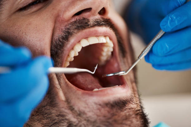Best Emergency Treatment for Toothache in Bay St Louis, MS