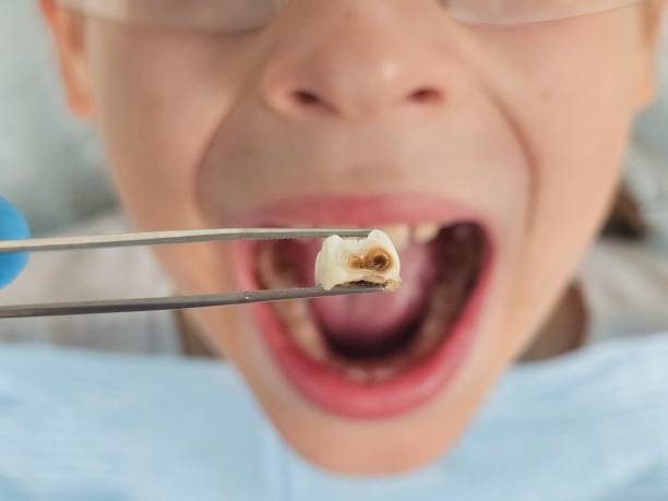 Best Walk-In Emergency Dentist in Bay St Louis, MS